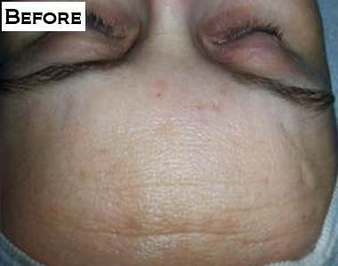 Eyelashes Extension Before